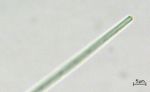 cyano_spitze6tn.jpg (1702 Byte)