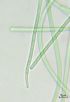 cyano_spitze7tn.jpg (1712 Byte)