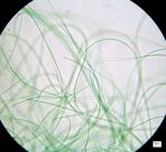 cyano_uebersicht1tn.jpg (5397 Byte)
